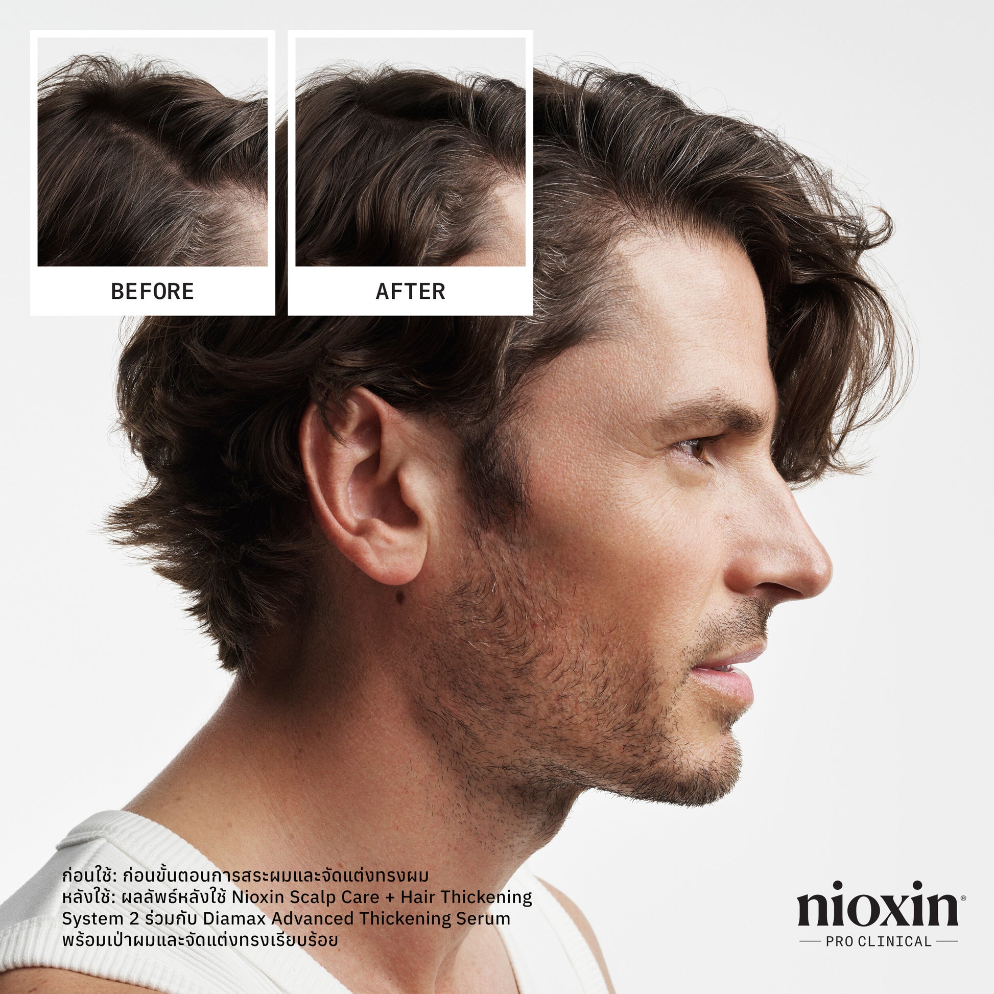 NIOXIN - Pro Clinical System Kit 2 - OCC LIFE