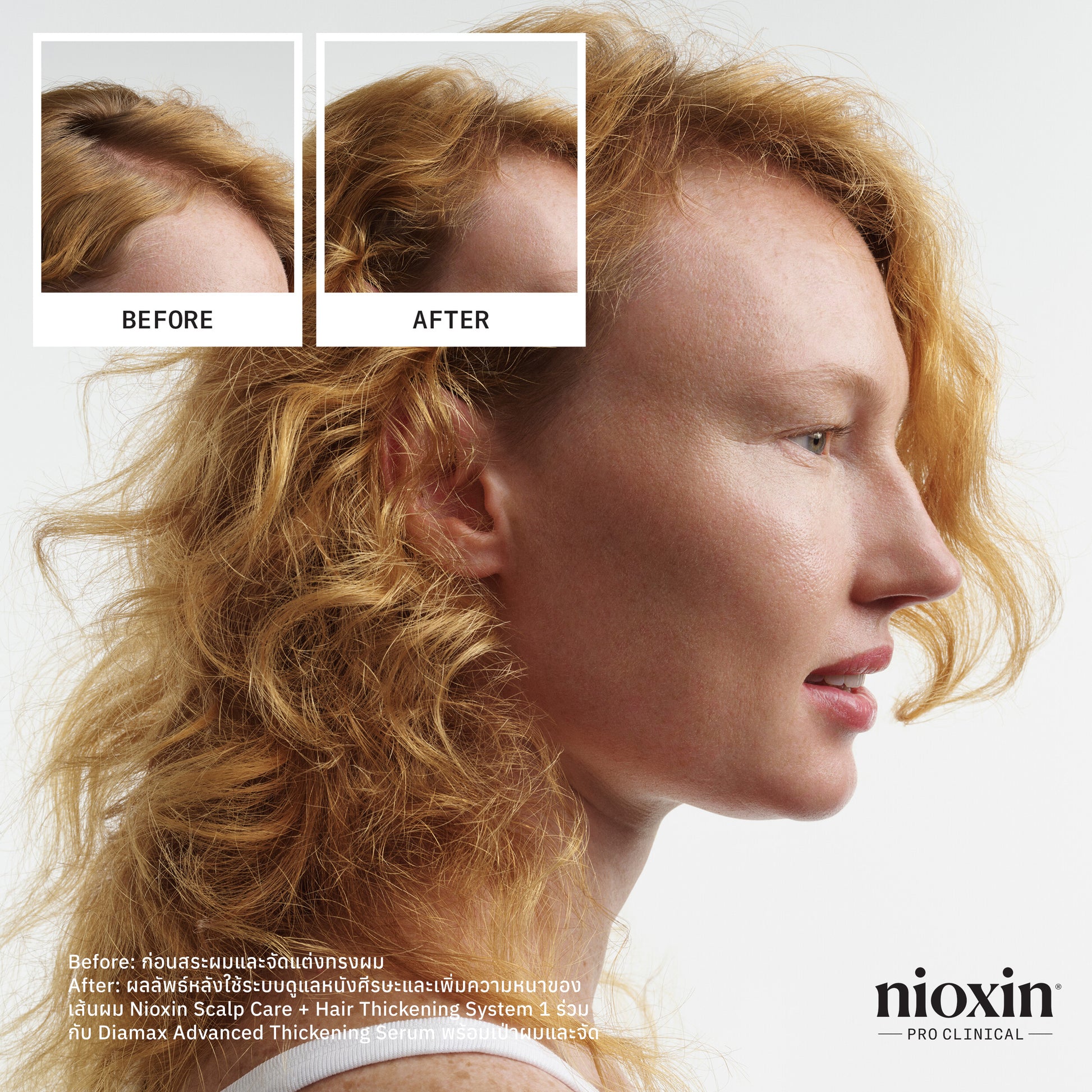 NIOXIN - System 4 Shampoo 300ml/1000ml - OCC LIFE