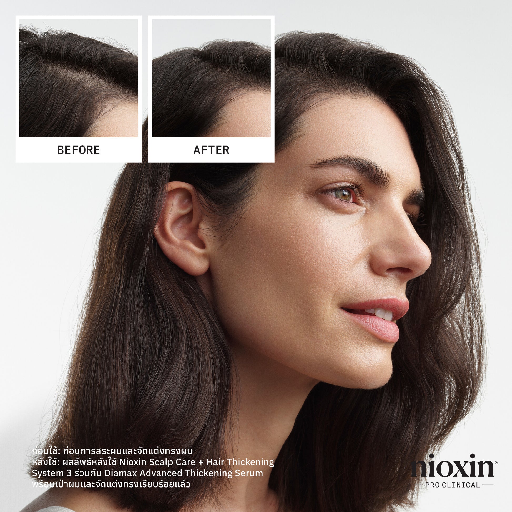 NIOXIN - System 3 Treatment 100ml - OCC LIFE